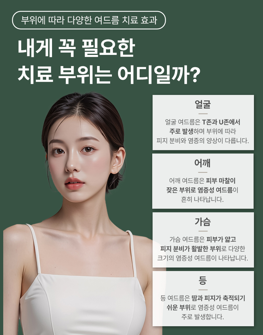 본문 내용을 보조하는 이미지