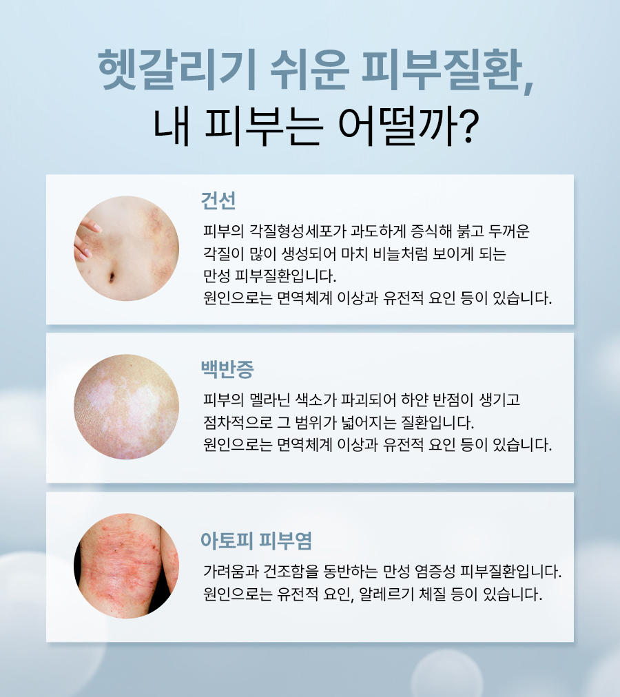 본문 내용을 보조하는 이미지