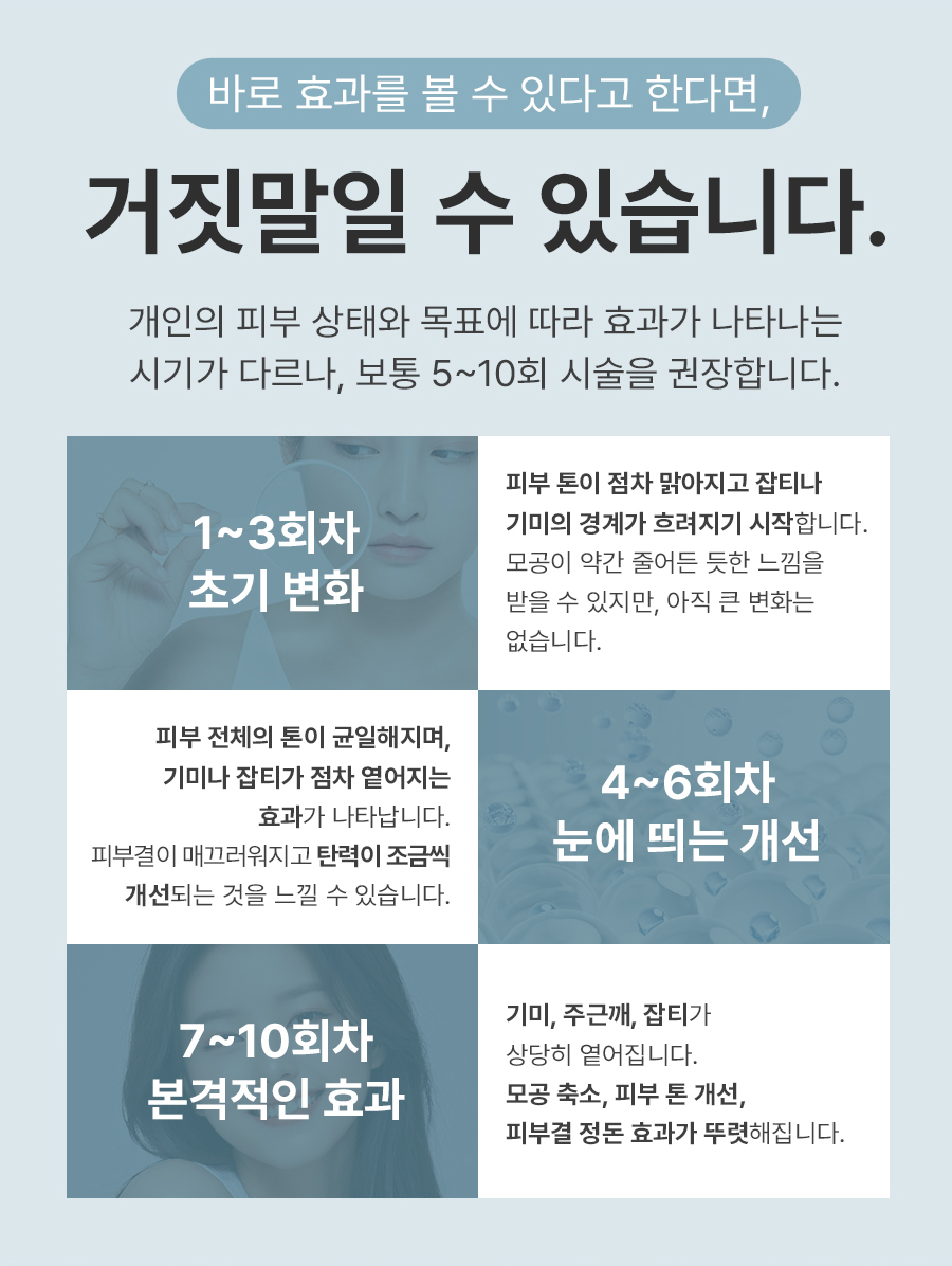기미잡티레이저가격 기준과 토닝 시술 전 확인사항