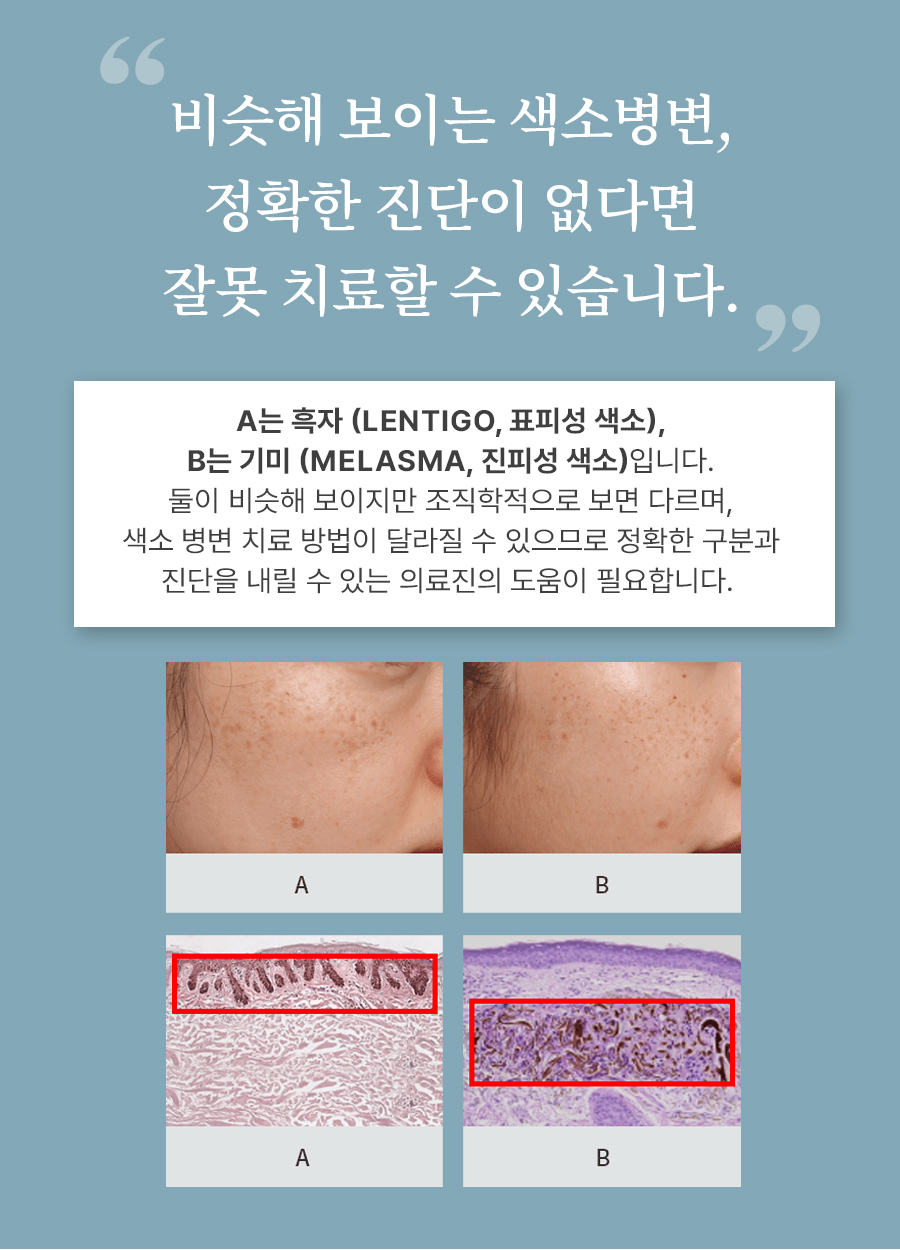 본문 내용을 보조하는 이미지