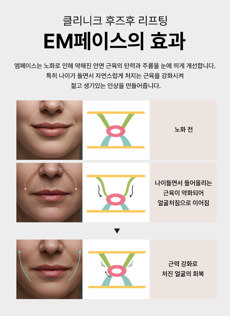 본문 내용을 보조하는 이미지