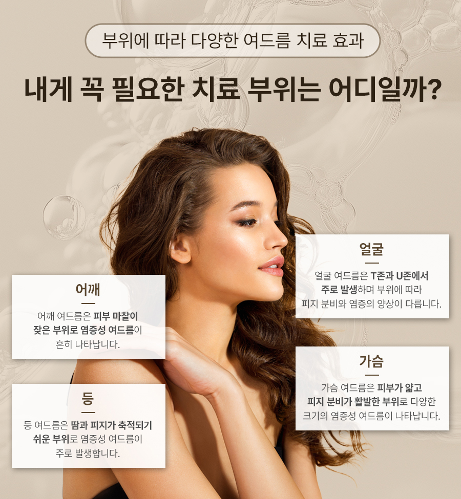 본문 내용을 보조하는 이미지