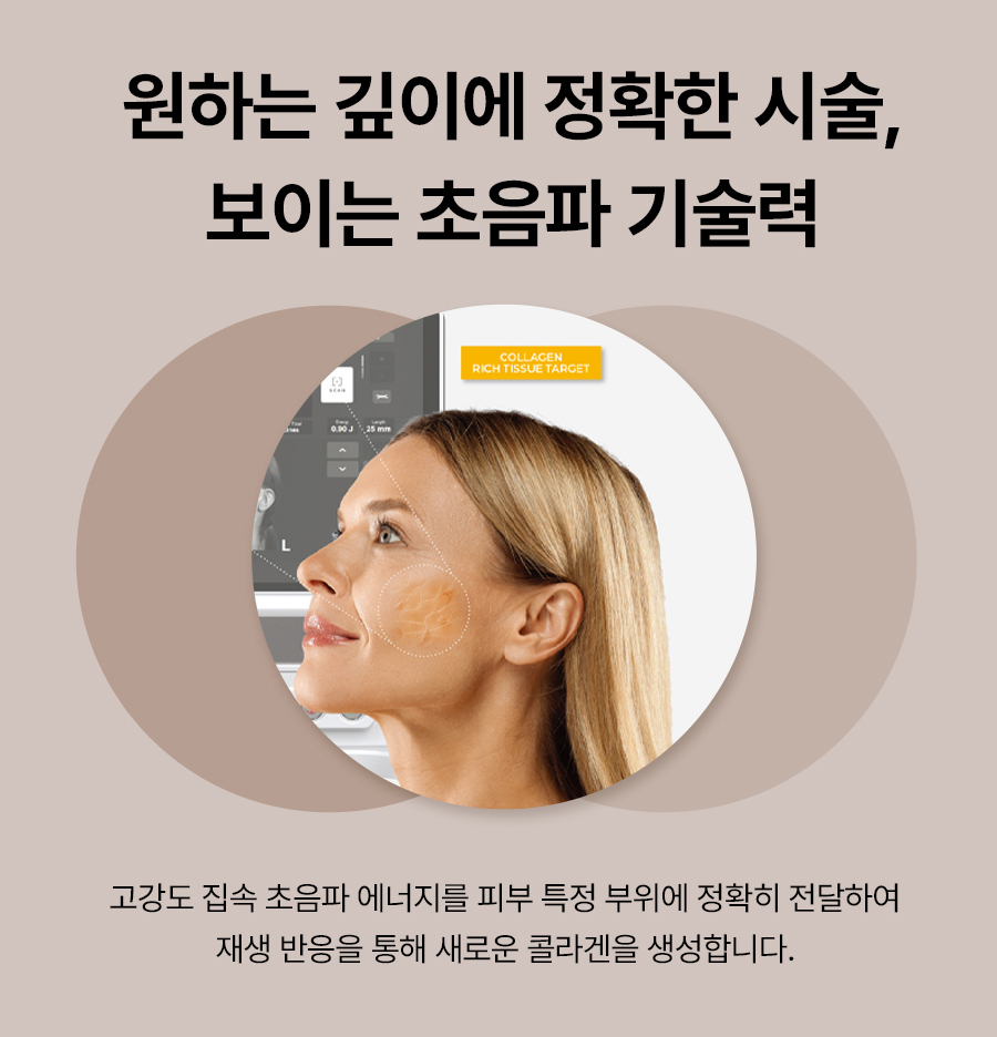 본문 내용을 보조하는 이미지