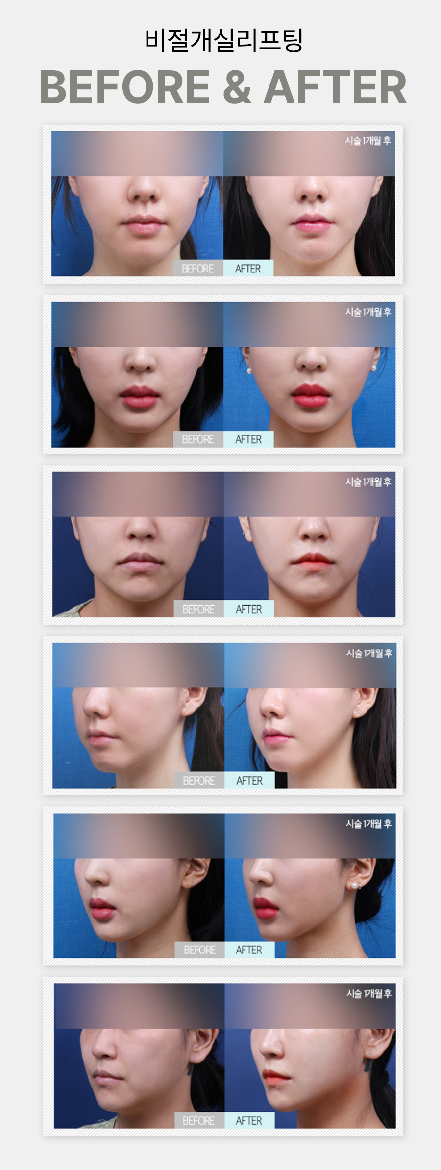 본문 내용을 보조하는 이미지