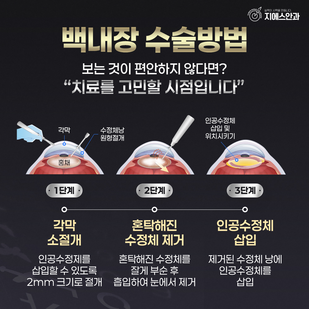 본문 내용을 보조하는 이미지