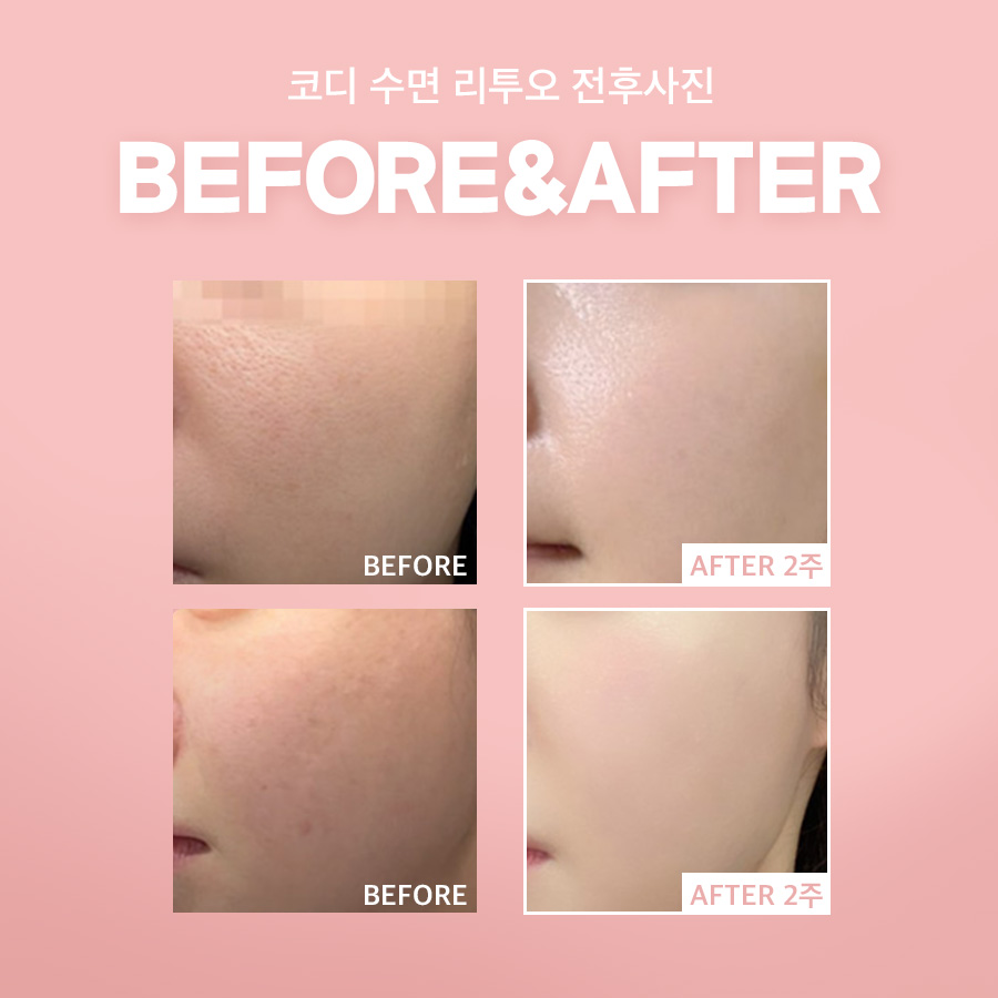 본문 내용을 보조하는 이미지