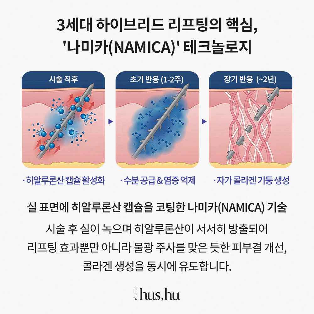 본문 내용을 보조하는 이미지