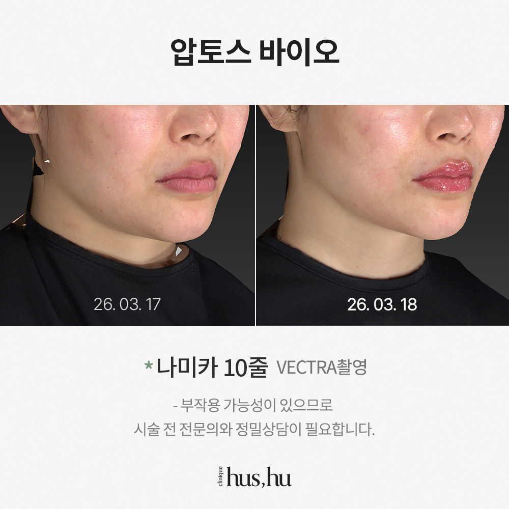 본문 내용을 보조하는 이미지
