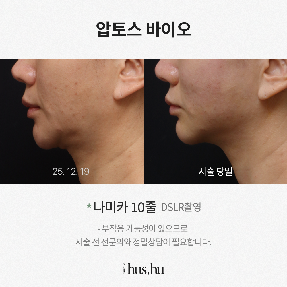 본문 내용을 보조하는 이미지