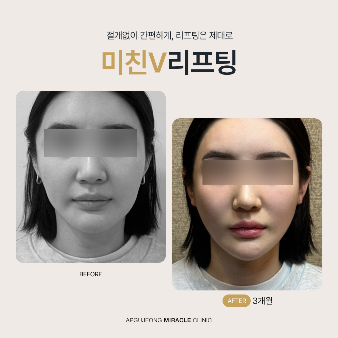 본문 내용을 보조하는 이미지