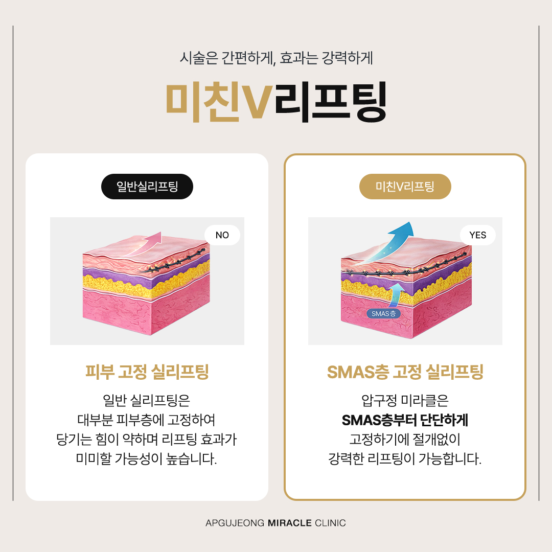 본문 내용을 보조하는 이미지