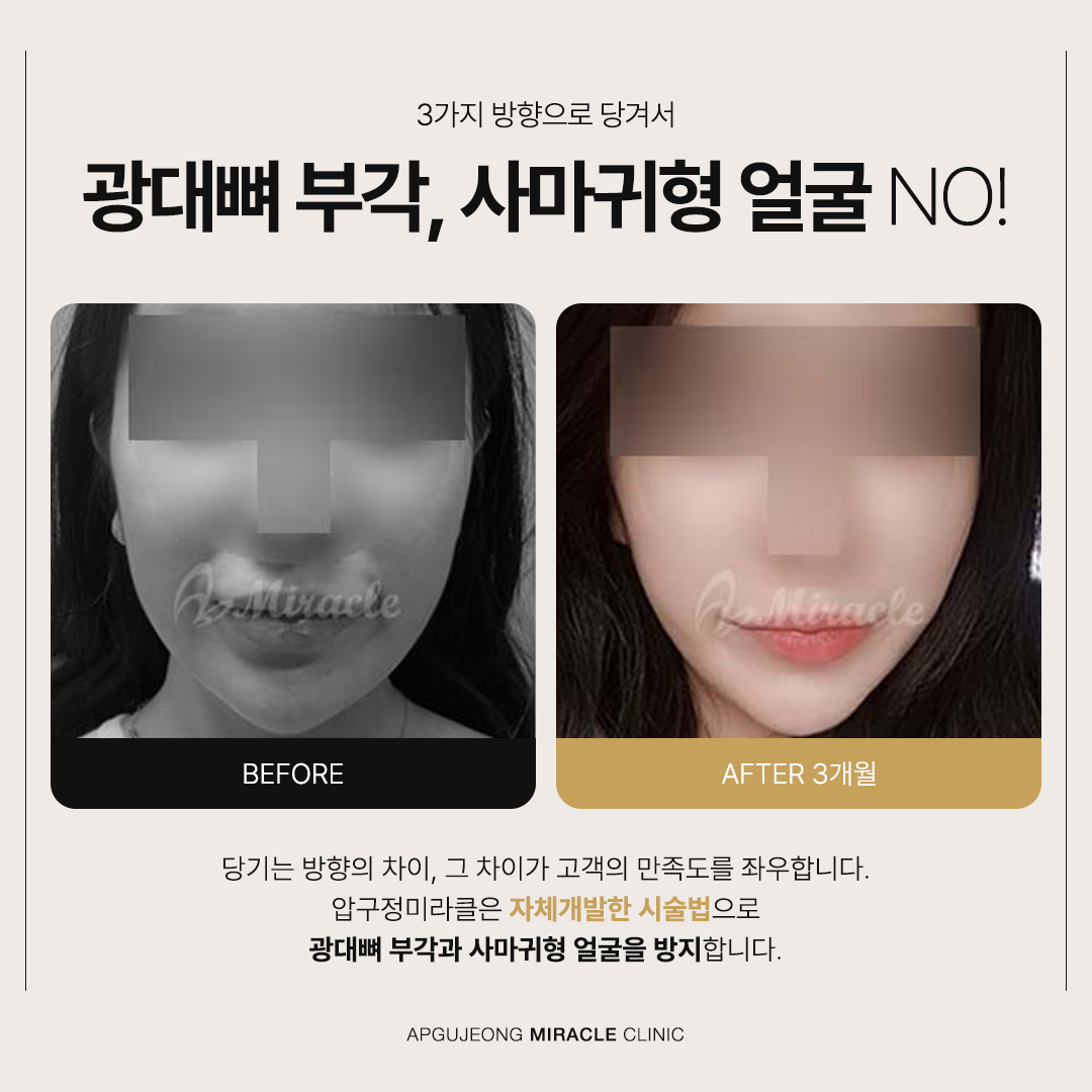 본문 내용을 보조하는 이미지