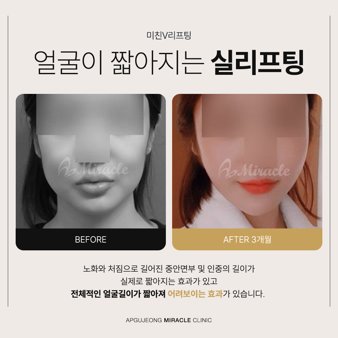 본문 내용을 보조하는 이미지