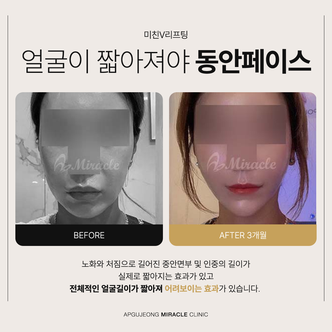 본문 내용을 보조하는 이미지