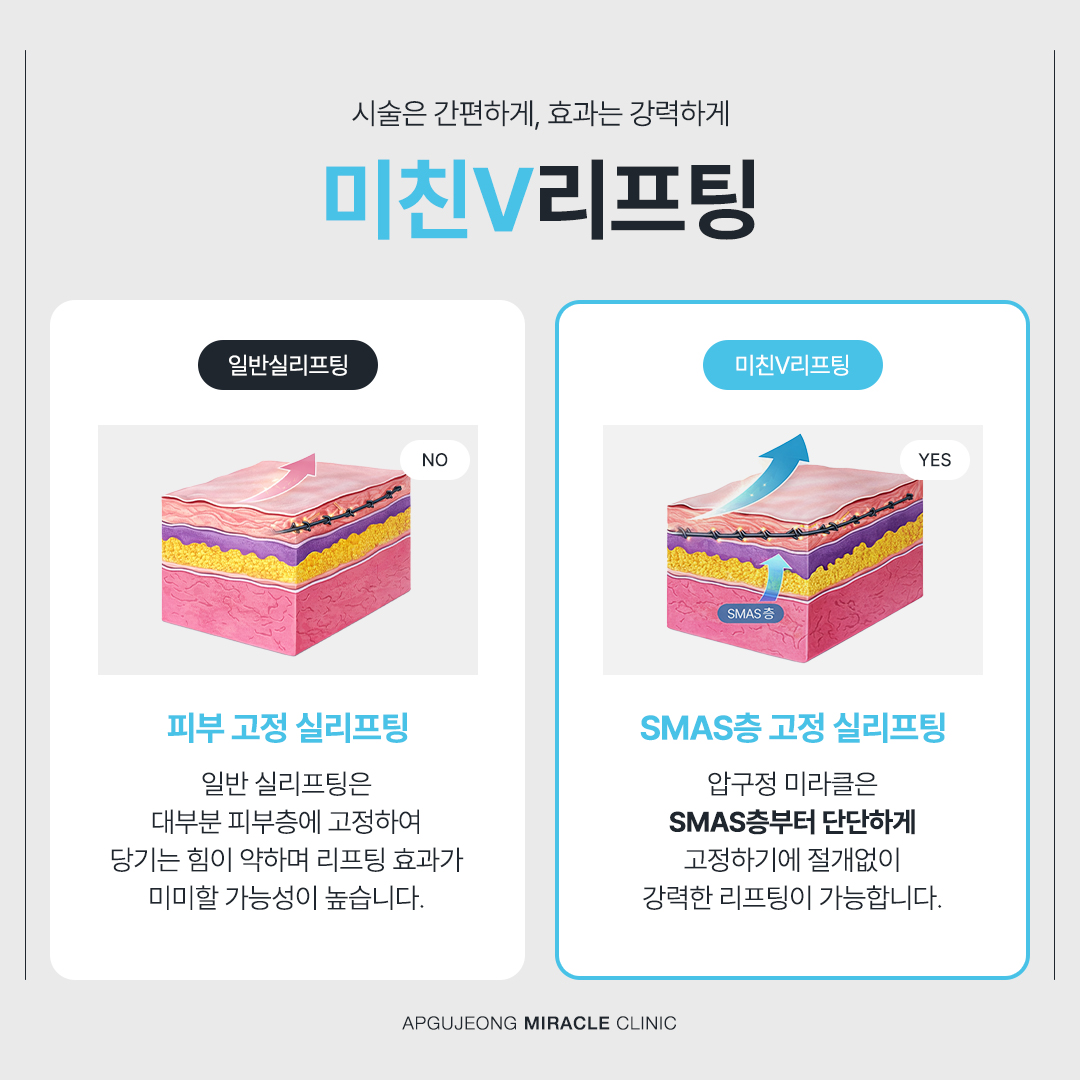 본문 내용을 보조하는 이미지