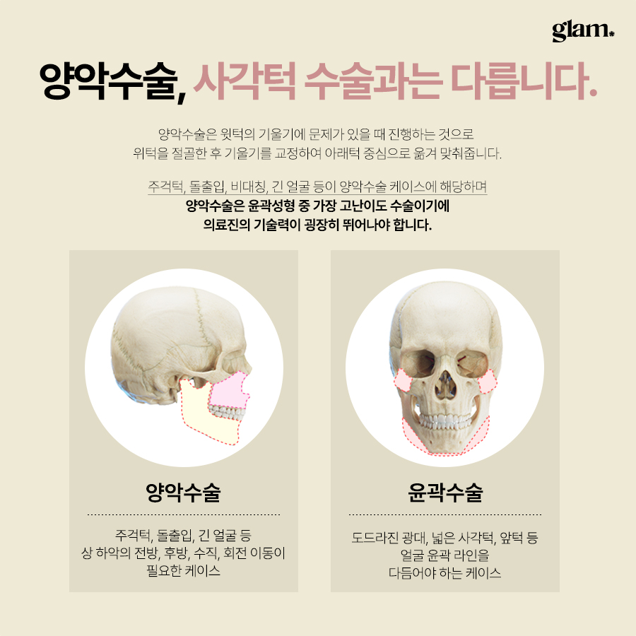 본문 내용을 보조하는 이미지