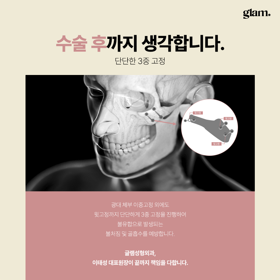 본문 내용을 보조하는 이미지