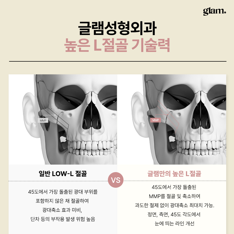 본문 내용을 보조하는 이미지