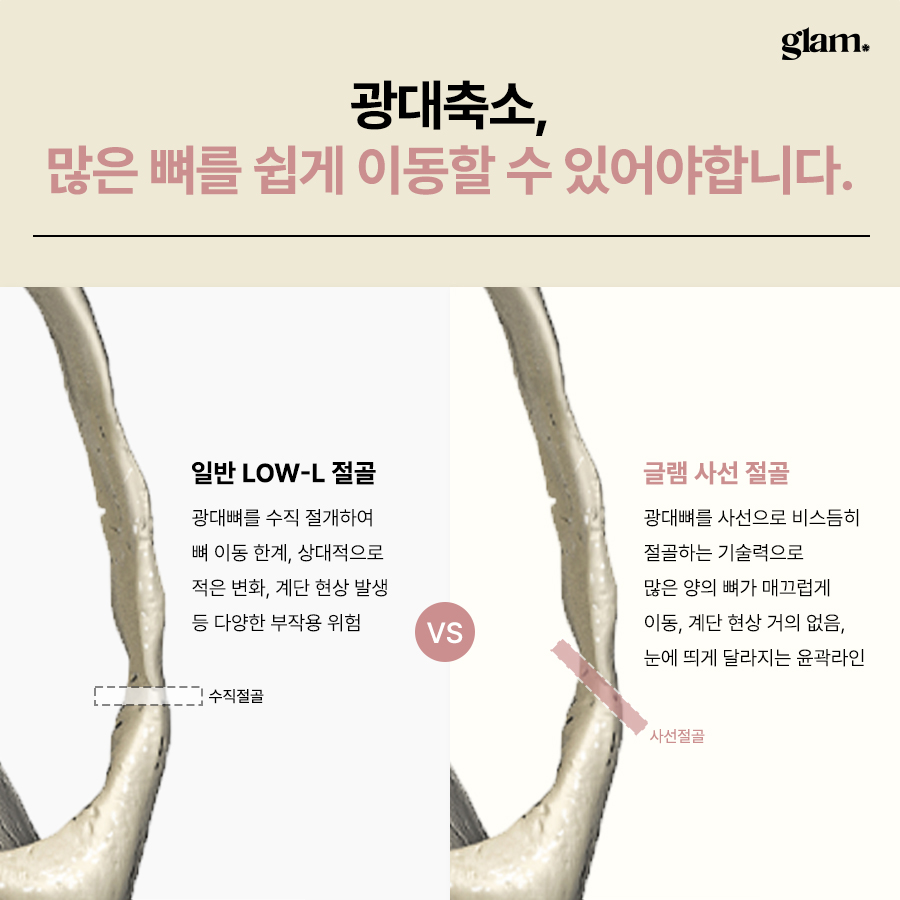 본문 내용을 보조하는 이미지