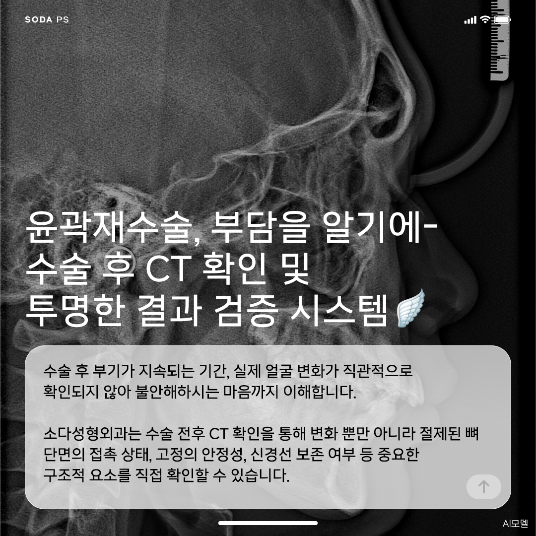 본문 내용을 보조하는 이미지