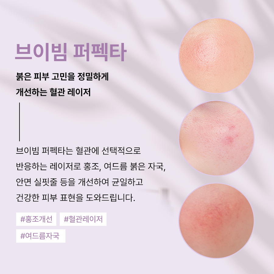 본문 내용을 보조하는 이미지