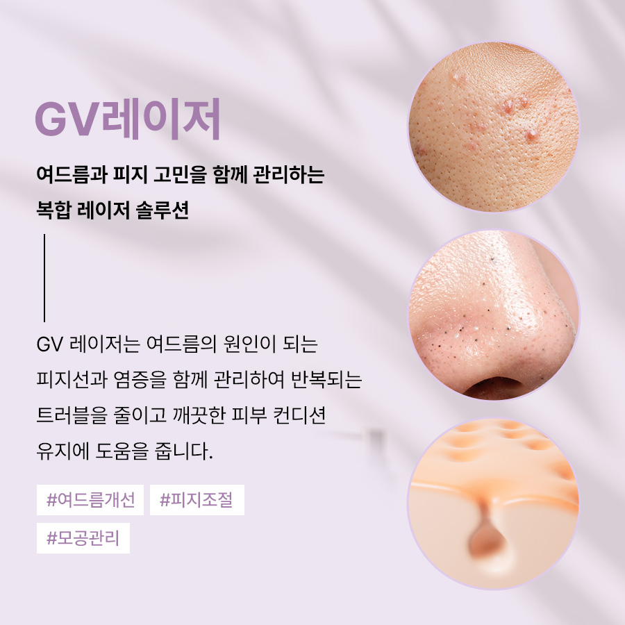 본문 내용을 보조하는 이미지