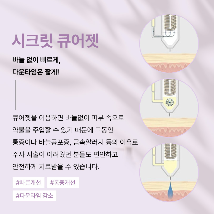 본문 내용을 보조하는 이미지