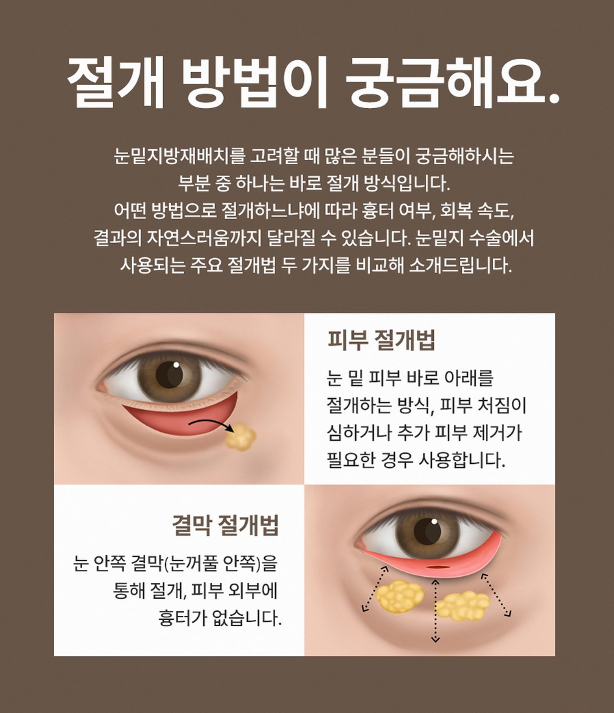 본문 내용을 보조하는 이미지