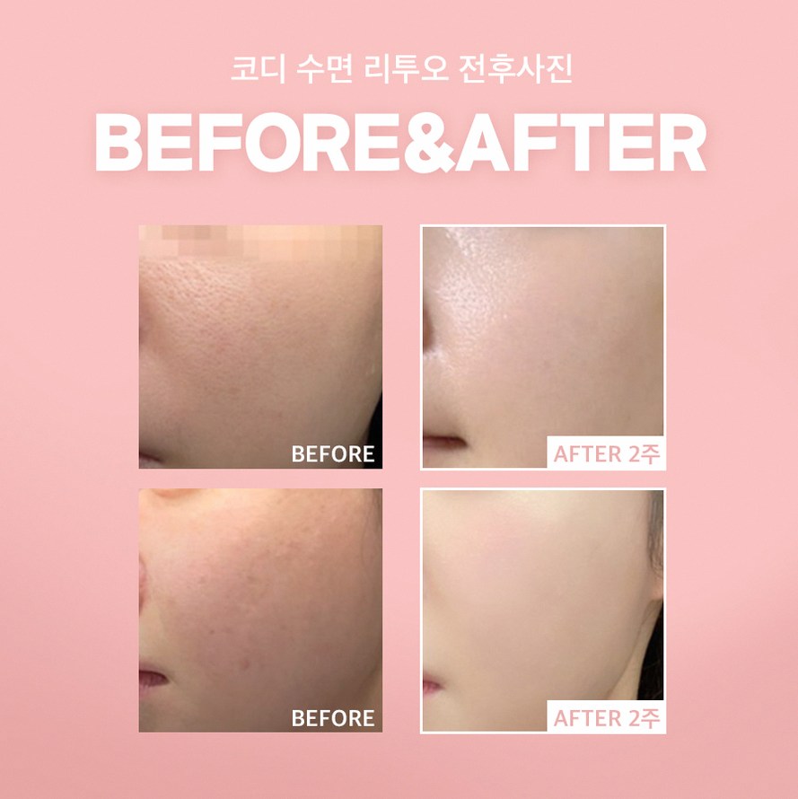 본문 내용을 보조하는 이미지