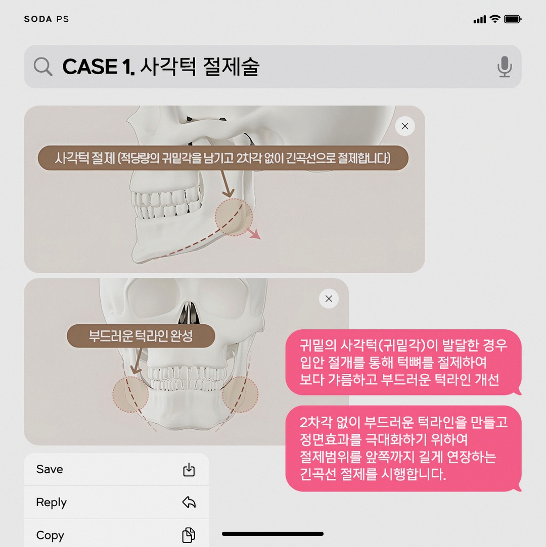 본문 내용을 보조하는 이미지