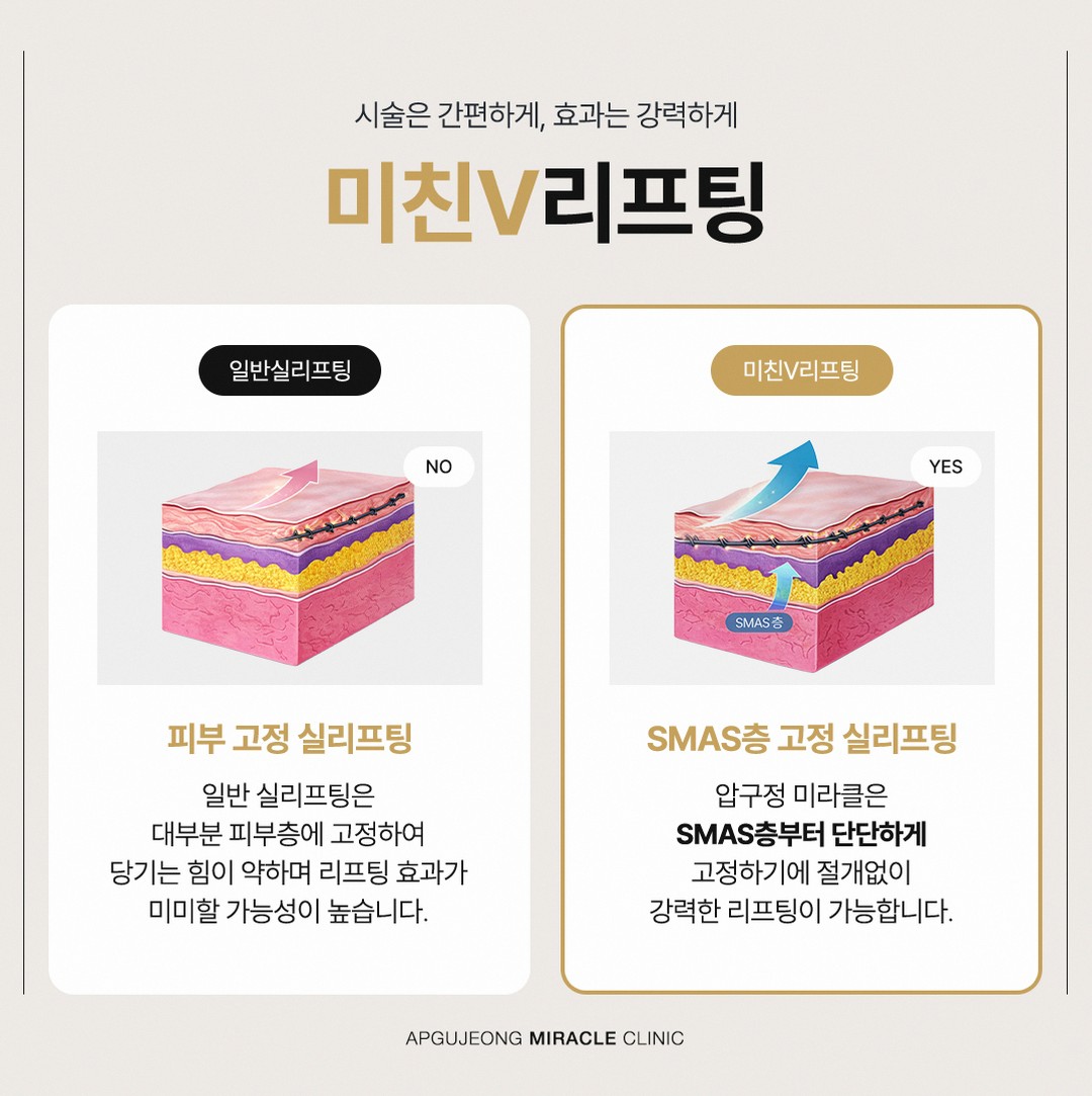 본문 내용을 보조하는 이미지