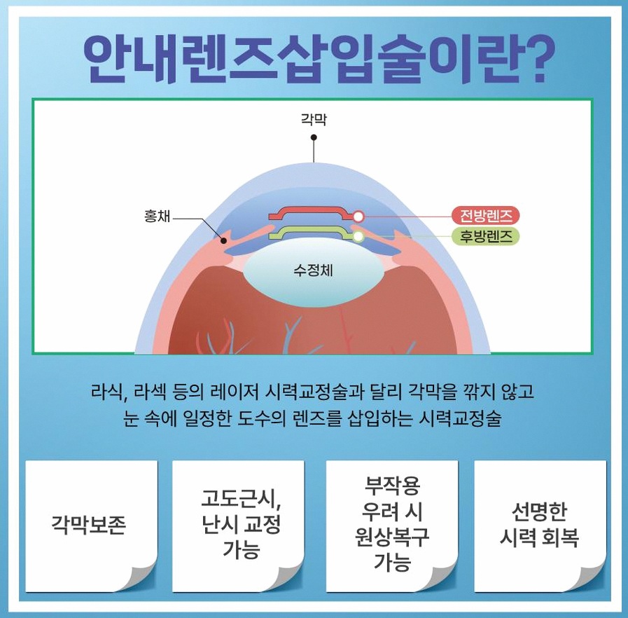 본문 내용을 보조하는 이미지