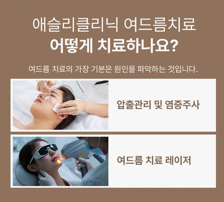본문 내용을 보조하는 이미지