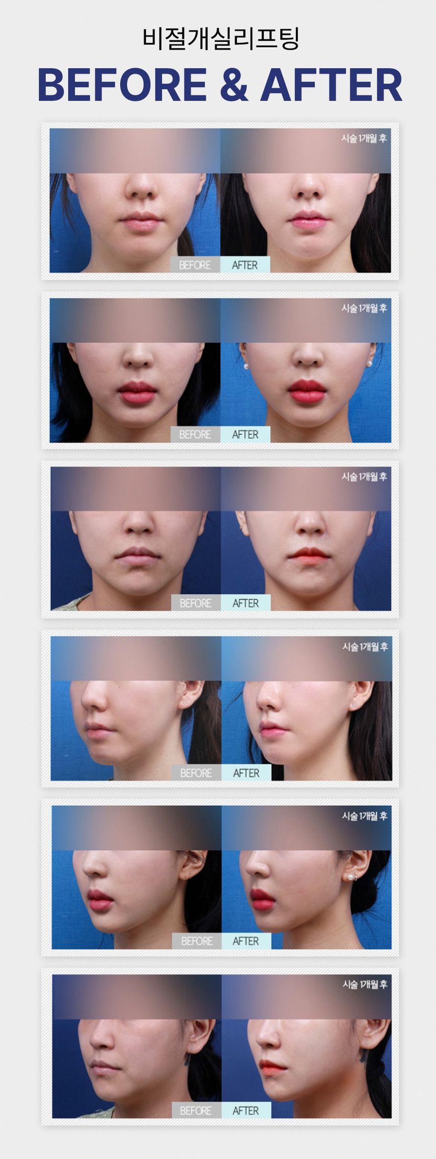 본문 내용을 보조하는 이미지