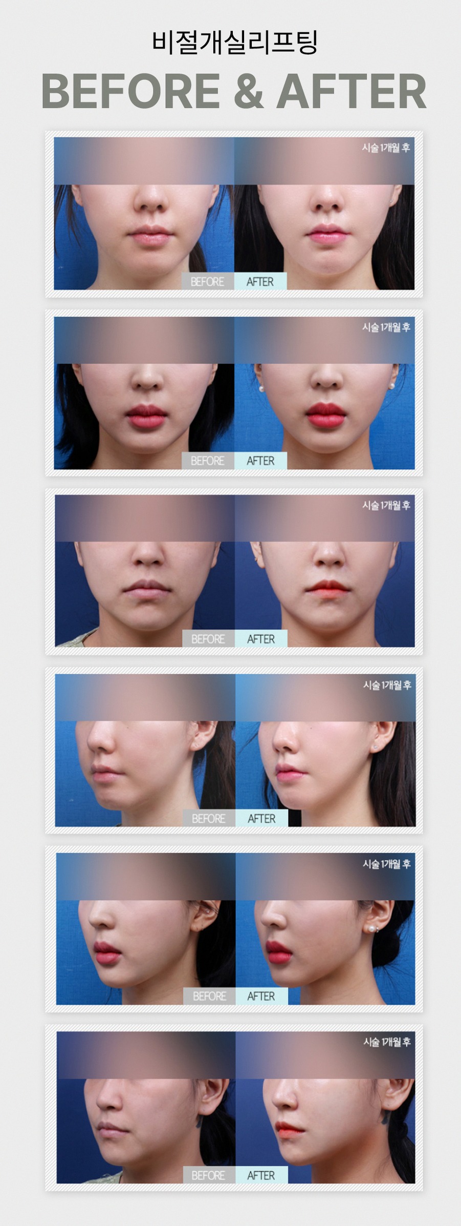 본문 내용을 보조하는 이미지
