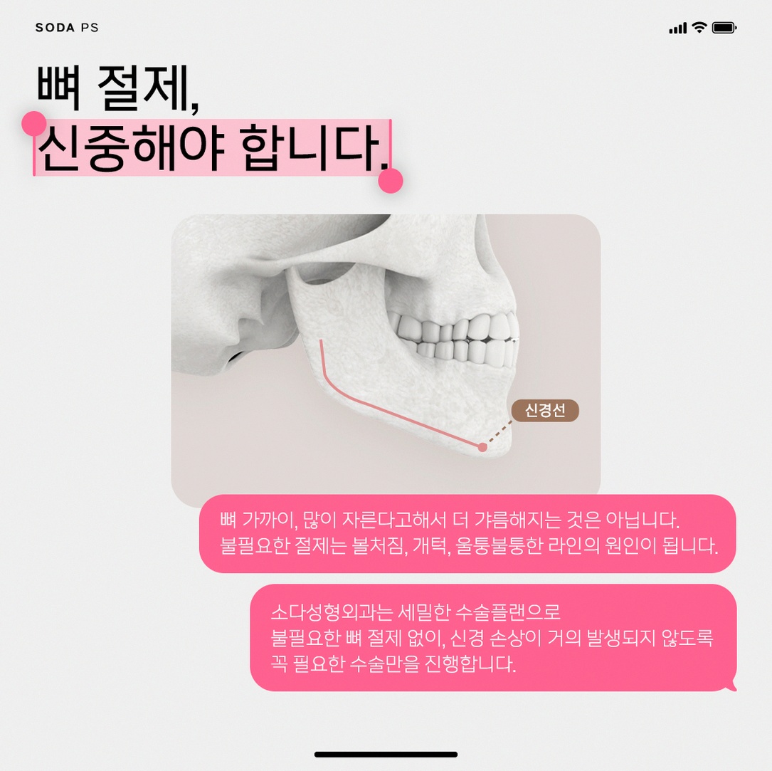 본문 내용을 보조하는 이미지
