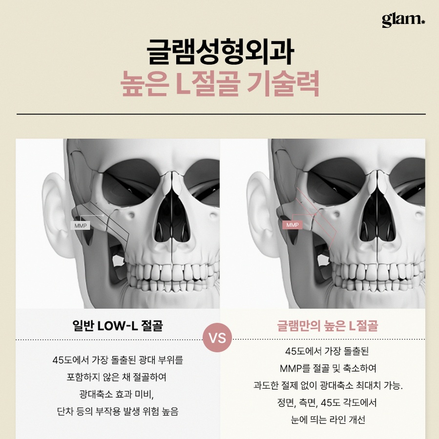 본문 내용을 보조하는 이미지
