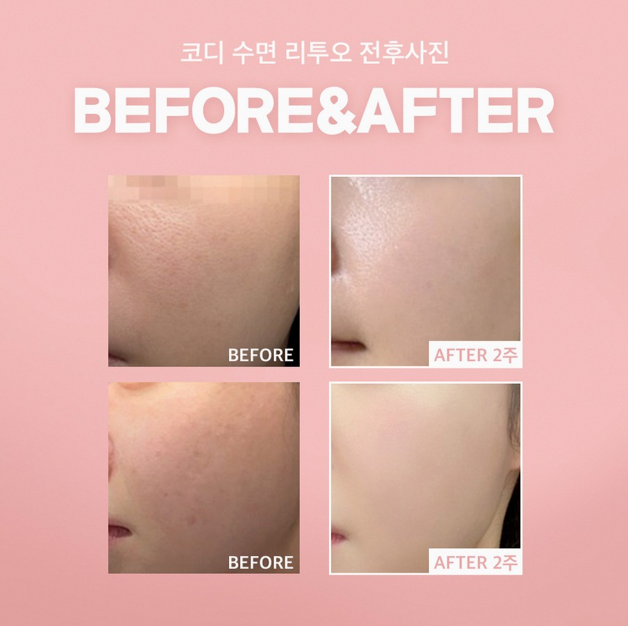 본문 내용을 보조하는 이미지