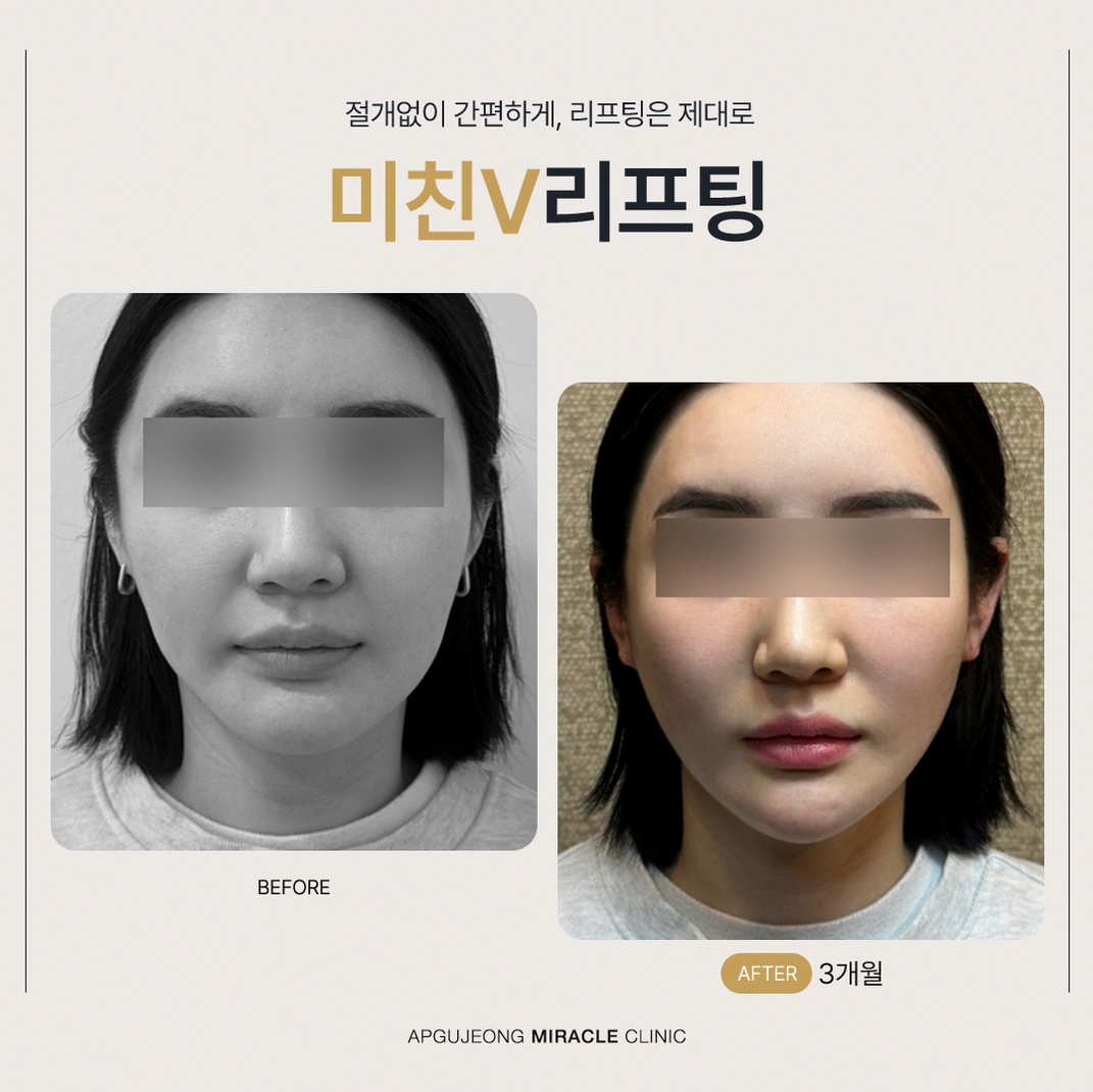 본문 내용을 보조하는 이미지