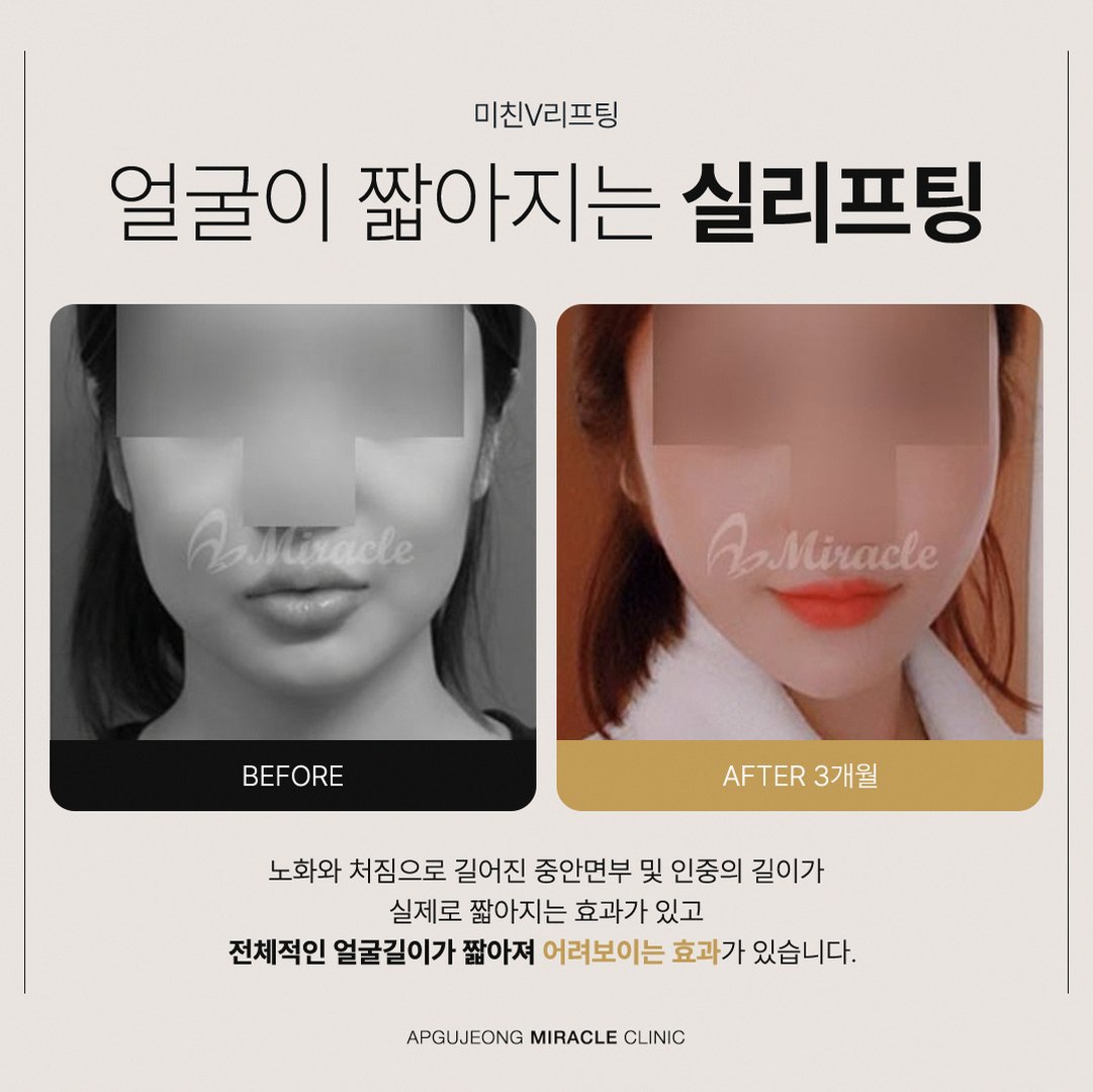 본문 내용을 보조하는 이미지