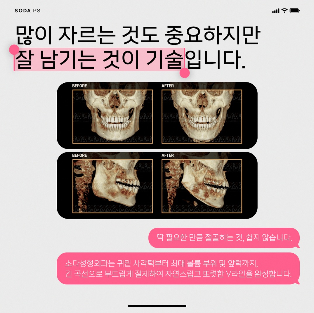 본문 내용을 보조하는 이미지