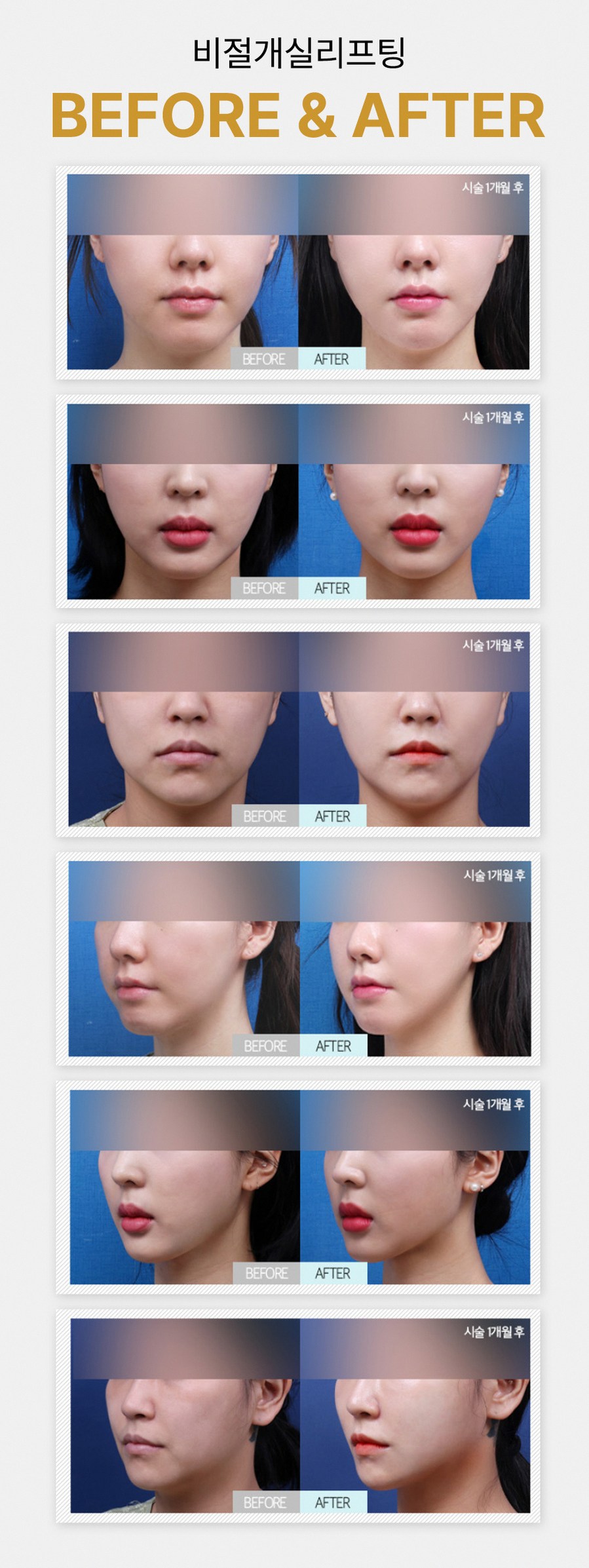 본문 내용을 보조하는 이미지