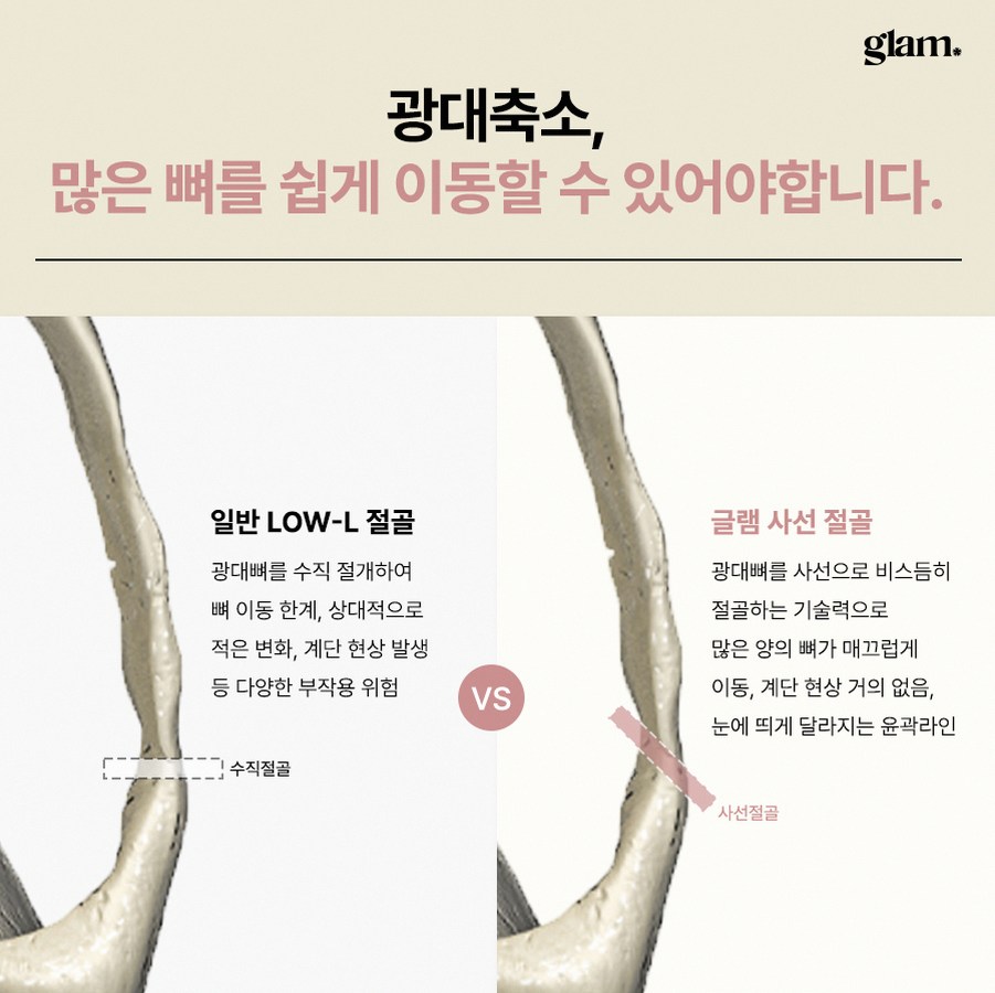 본문 내용을 보조하는 이미지