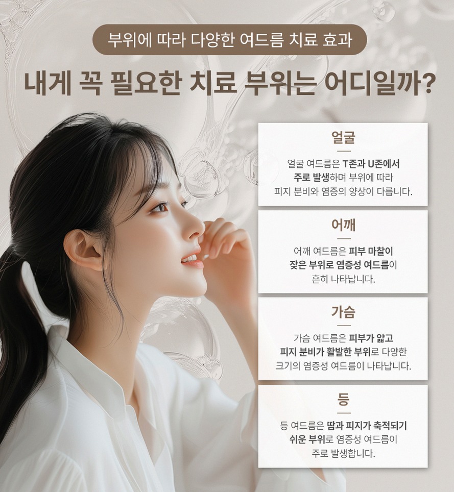 본문 내용을 보조하는 이미지