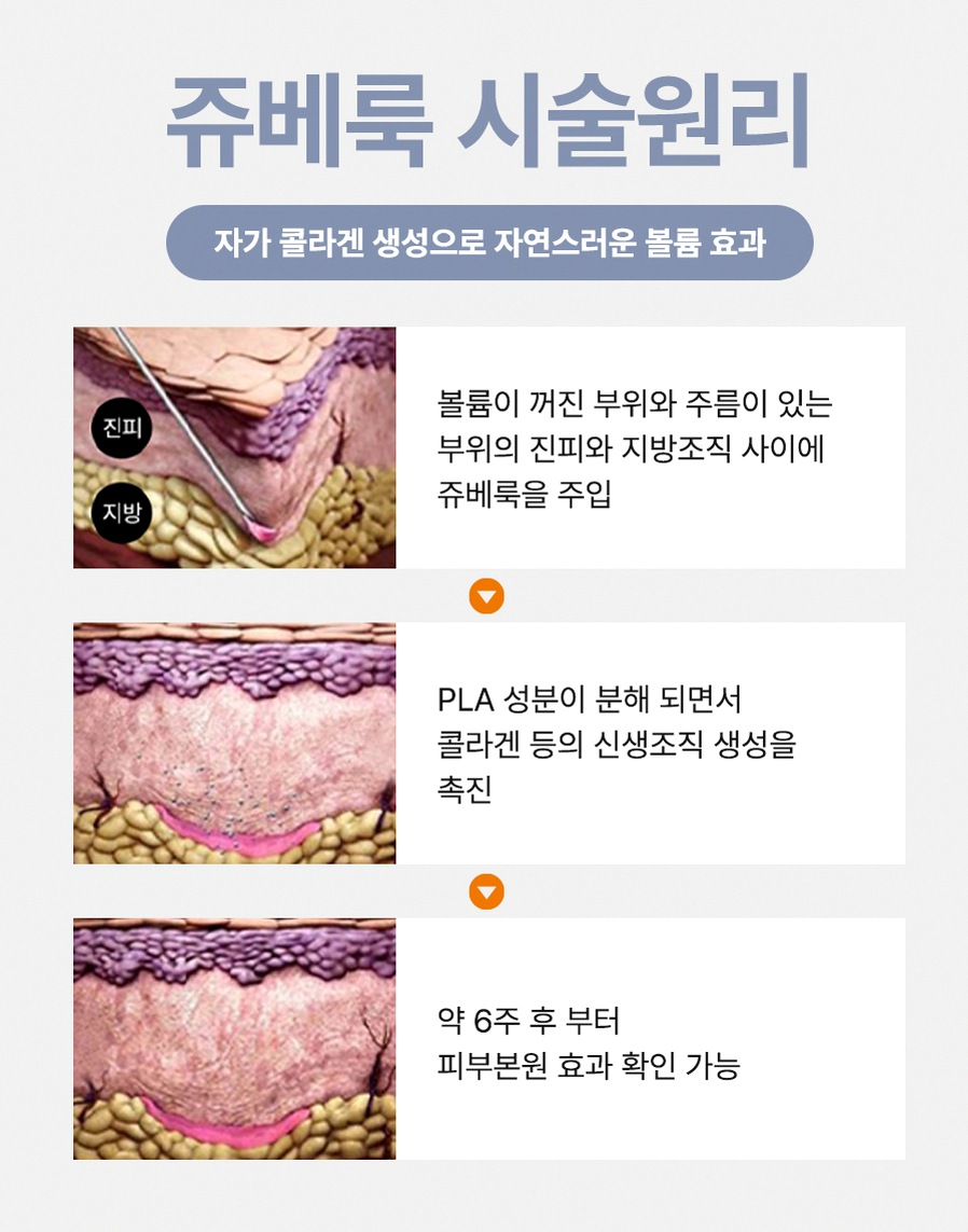본문 내용을 보조하는 이미지