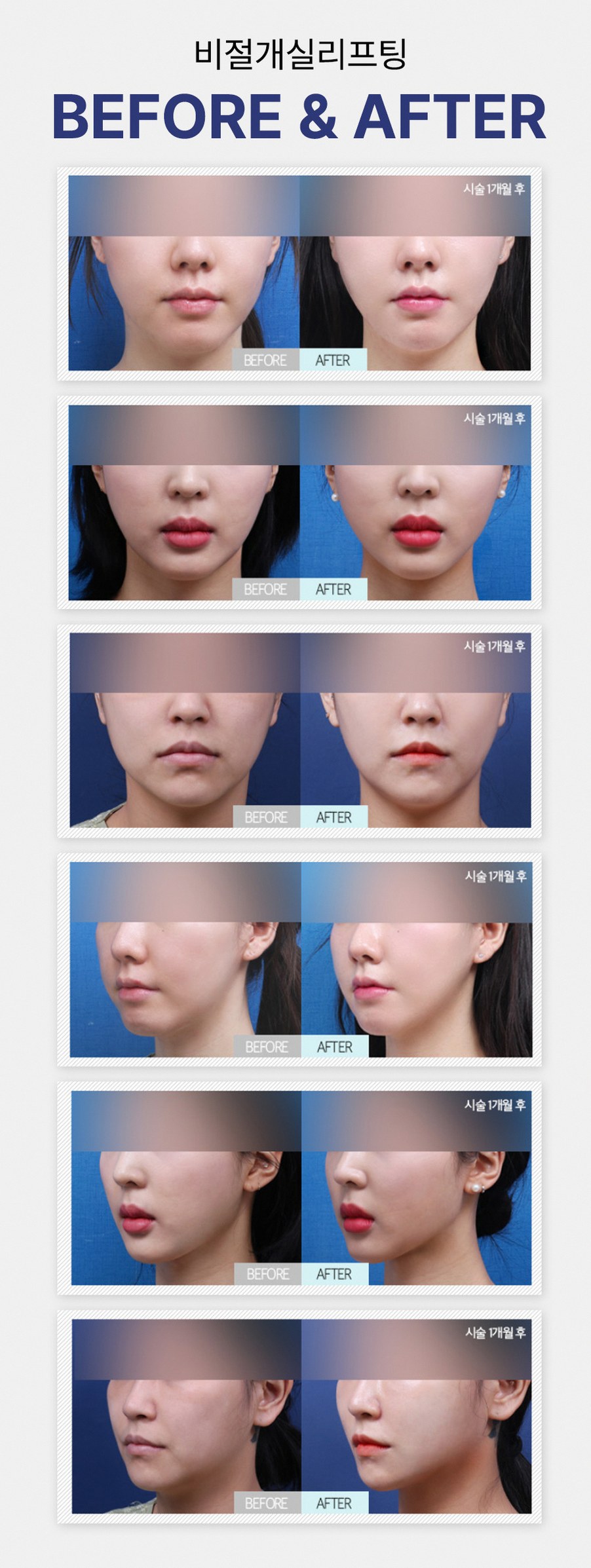 본문 내용을 보조하는 이미지
