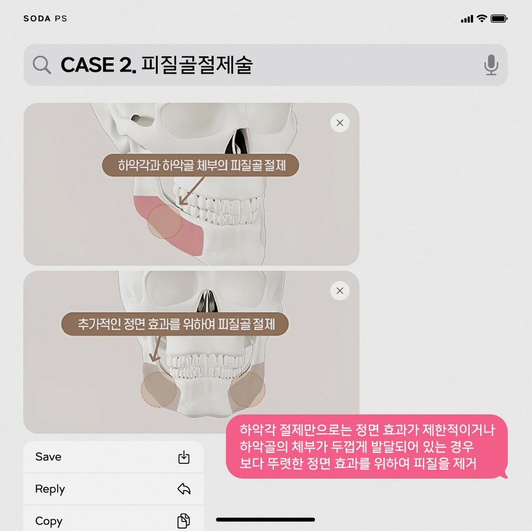 본문 내용을 보조하는 이미지