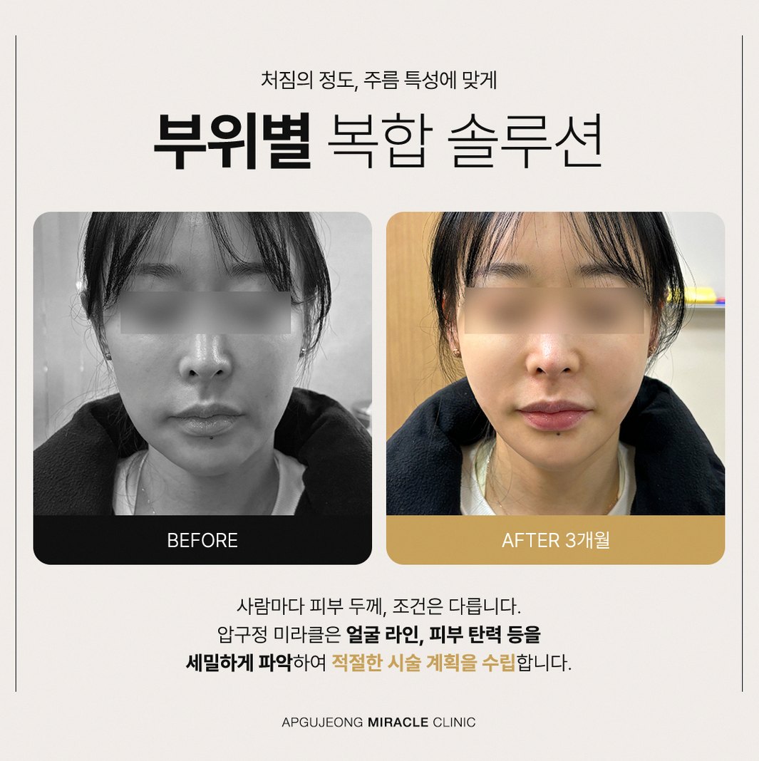본문 내용을 보조하는 이미지