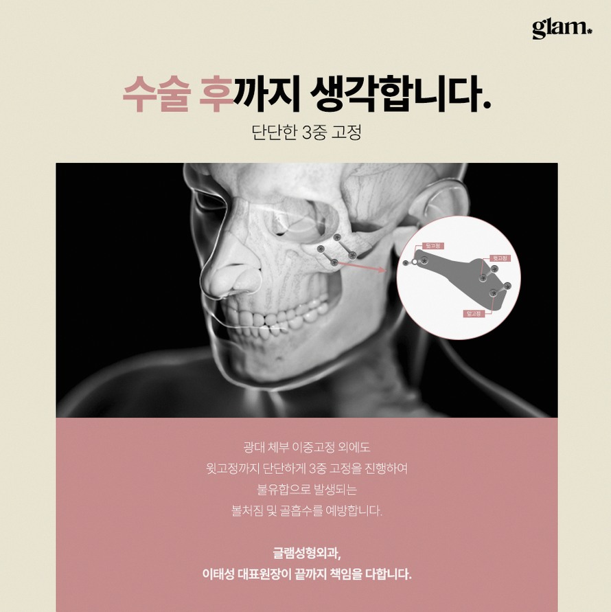 본문 내용을 보조하는 이미지