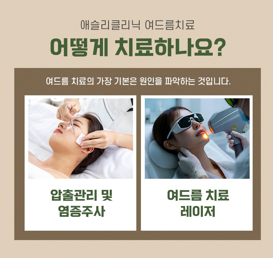 본문 내용을 보조하는 이미지